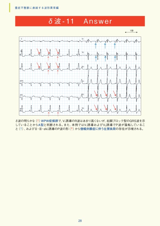 心電図最後の教科書 不整脈編 | 谷口 総志 |本 | 通販 | Amazon
