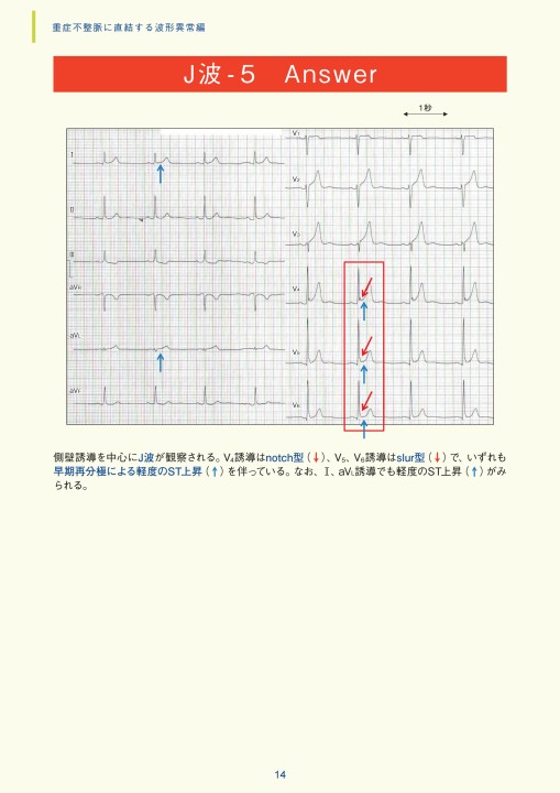 Amazon.co.jp: 古典力学 上 新版 (物理学叢書 11a) : ゴールド