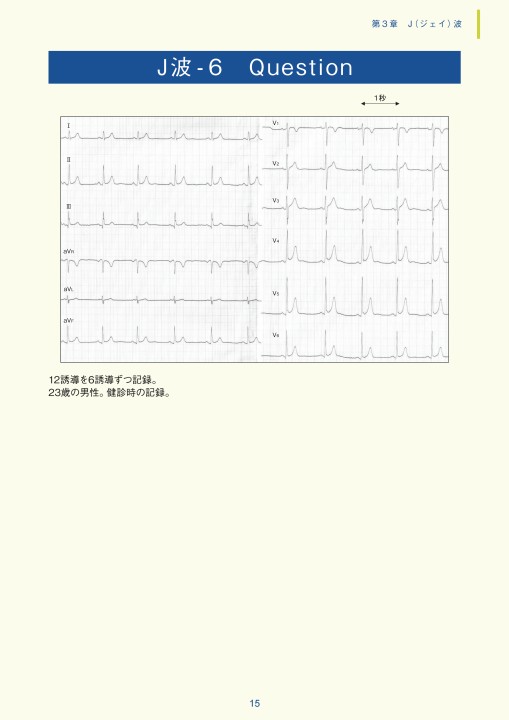 実力心電図 日本光電工業〉心電図モニター 音 アラーム音 - YouTube