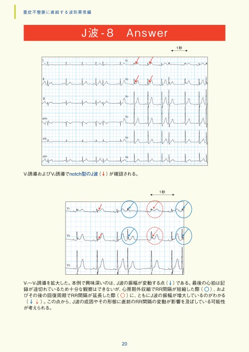 第3章|臨床心電図解析の実際 - 不整脈関連波形異常編 第3章|臨床心電図解析の実際 - 不整脈関連波形異常編