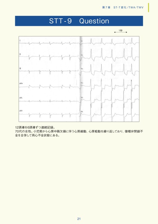 第7章｜臨床心電図解析の実際 - 不整脈関連波形異常編