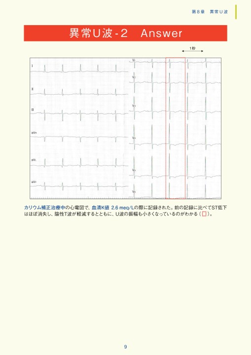 第8章｜臨床心電図解析の実際 - 不整脈関連波形異常編