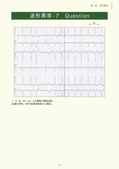 m*m様 実力心電図　改訂版 2・3級合格をつかむ心電図問題集160＆とことん解説 – 丸善