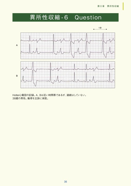 ジョセフソン臨床心臓電気生理学 第2版 ジョセフソン臨床心臓電気生理学 第2版: 手技と解釈 | M.E.