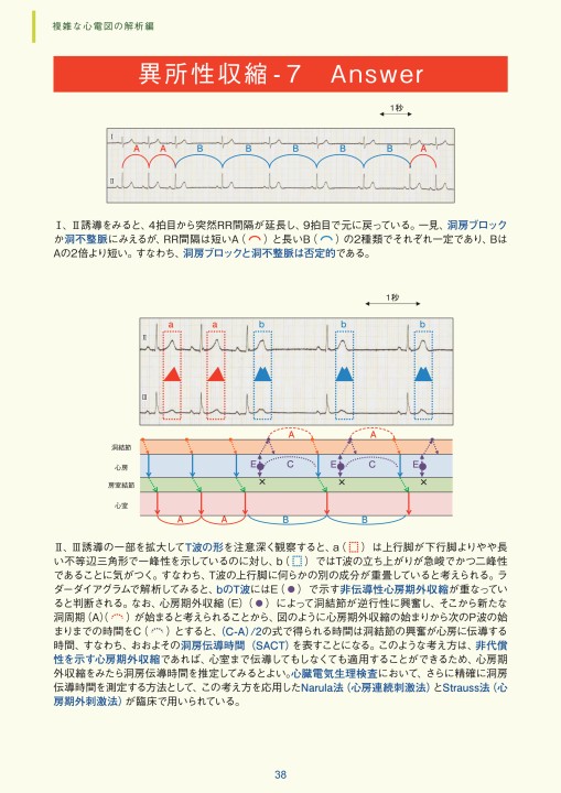 臨床心電図解析の実際 - 複雑な心電図の解析編