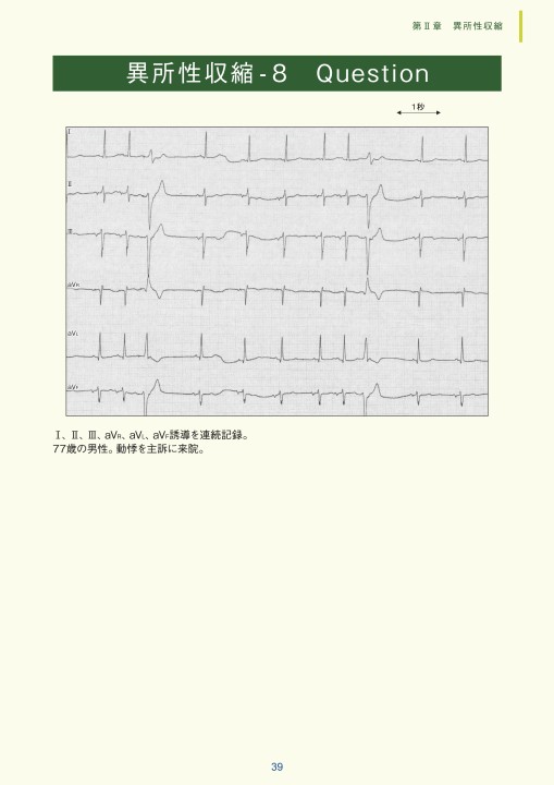 ジョセフソン臨床心臓電気生理学 第2版 ジョセフソン臨床心臓電気生理学 第2版: 手技と解釈 | M.E.