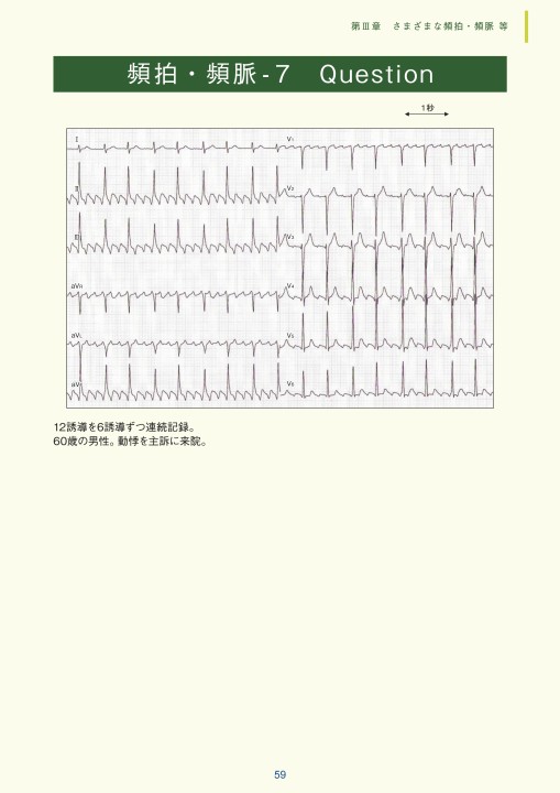 徹底解説!心電図: 基礎から臨床まで 徹底解説!心電図: 基礎から臨床まで | 森博愛 |本 | 通販 | Amazon