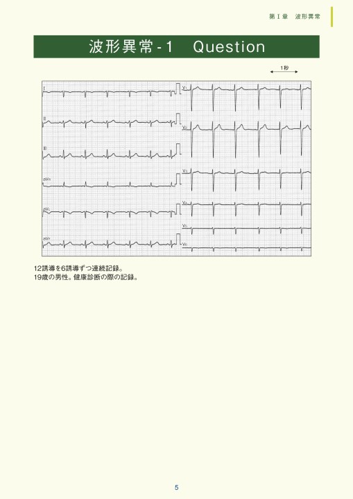 徹底解説!心電図: 基礎から臨床まで 徹底解説!心電図: 基礎から臨床まで | 森博愛 |本 | 通販 | Amazon