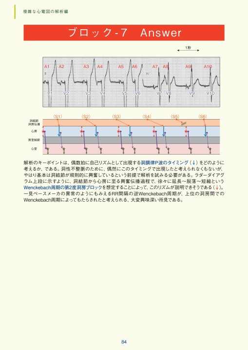 実力心電図 Amazon.co.jp: 実力心電図: 「読める」のその先へ : 日本不整脈