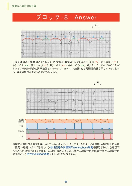 臨床心電図解析の実際 - 複雑な心電図の解析編
