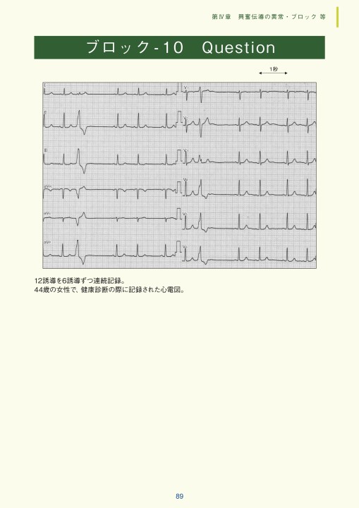 実力心電図 Amazon.co.jp: 実力心電図: 「読める」のその先へ : 日本不整脈