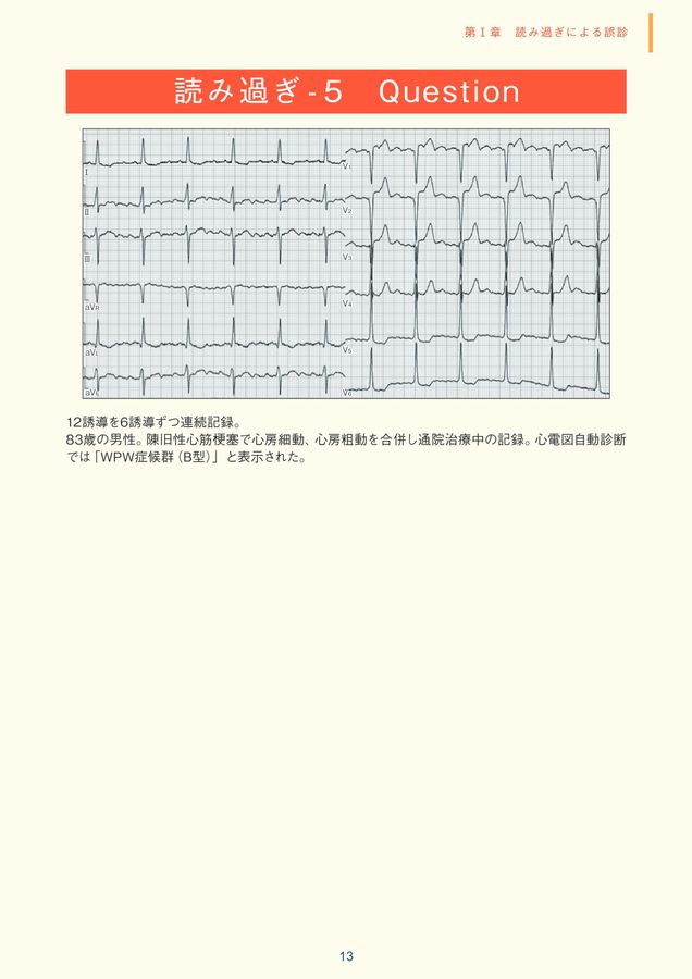 臨床心電図解析の実際 ― 不適切自動診断編
