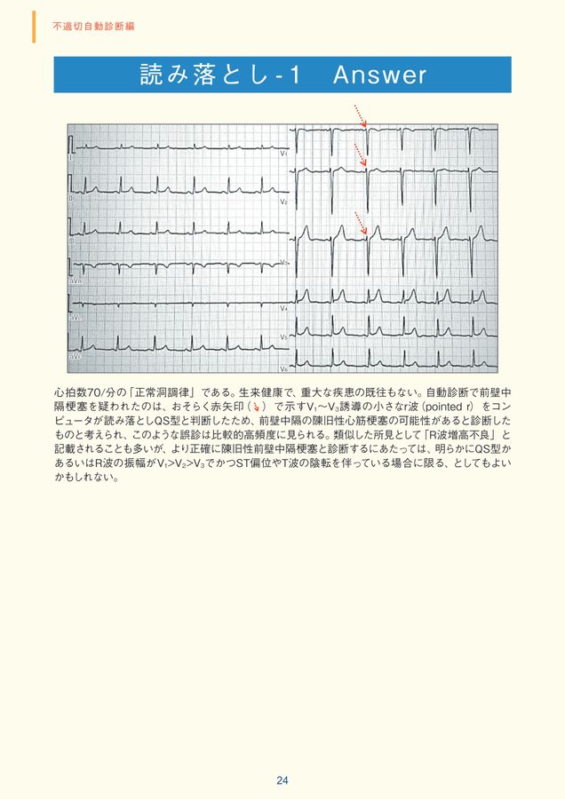心様確認用 LOTUS様確認用 LOTUS様確認用 LOTUS様確認用 交換レンズ用プロテクト