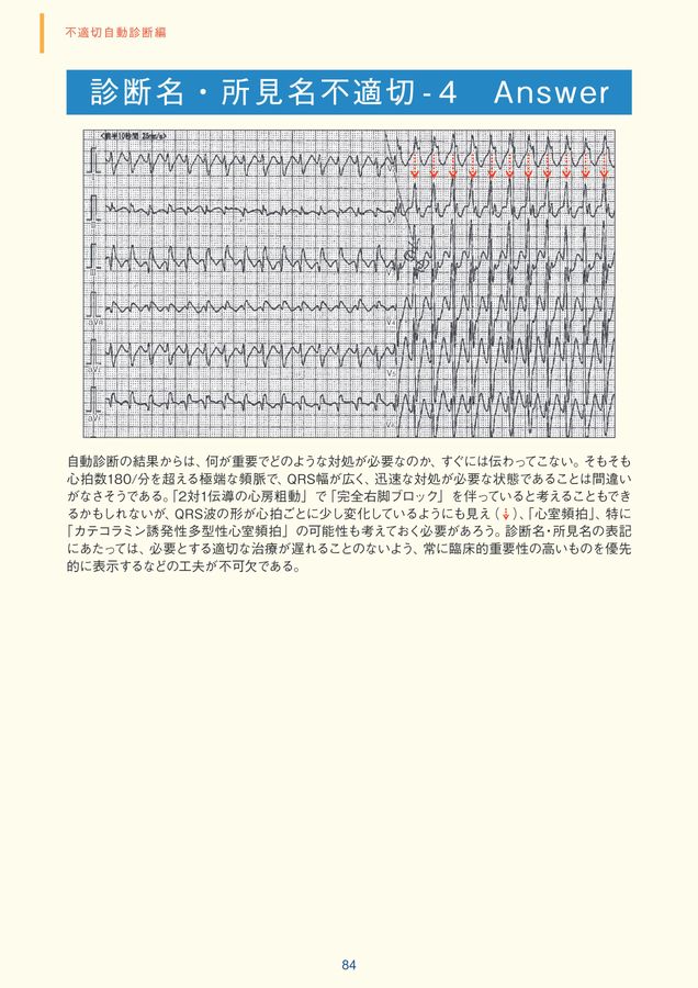 臨床心電図解析の実際 ― 不適切自動診断編