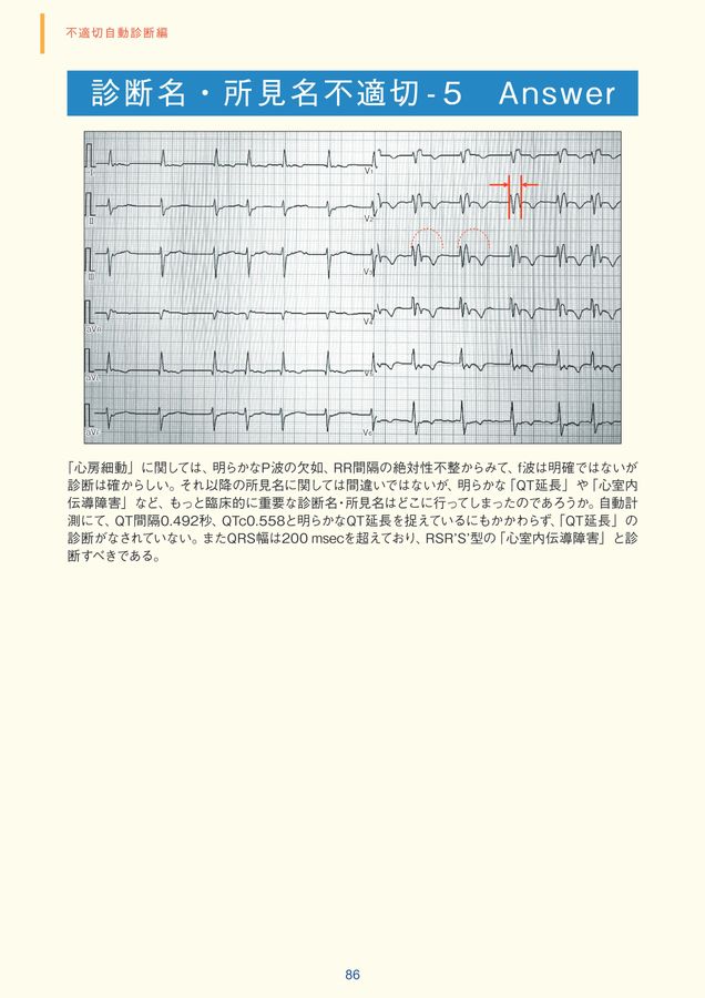 臨床心電図解析の実際 ― 不適切自動診断編