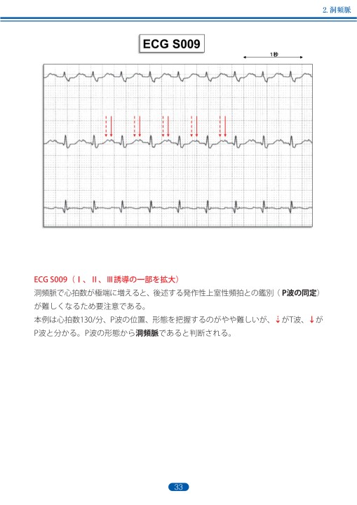 臨床心電図解析の実際 - 不整脈編 第1章・第2章