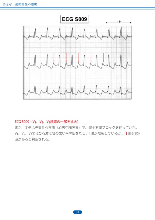 臨床心電図解析の実際 - 不整脈編 第1章・第2章