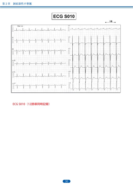 臨床心電図解析の実際 - 不整脈編 第1章・第2章