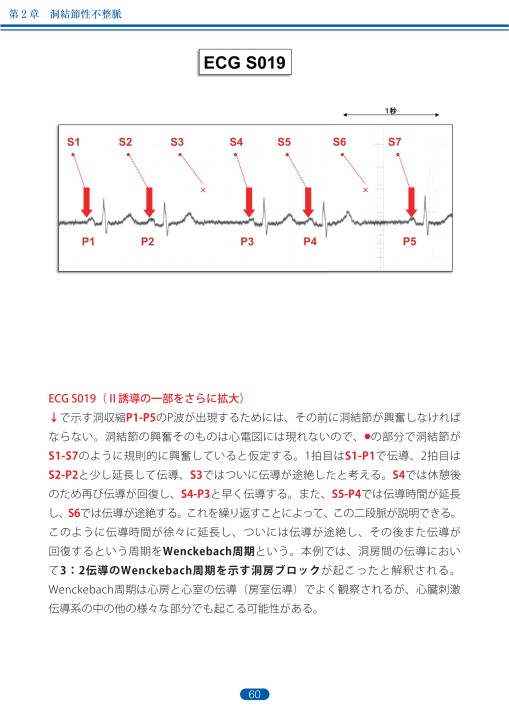 臨床心電図解析の実際 - 不整脈編 第1章・第2章