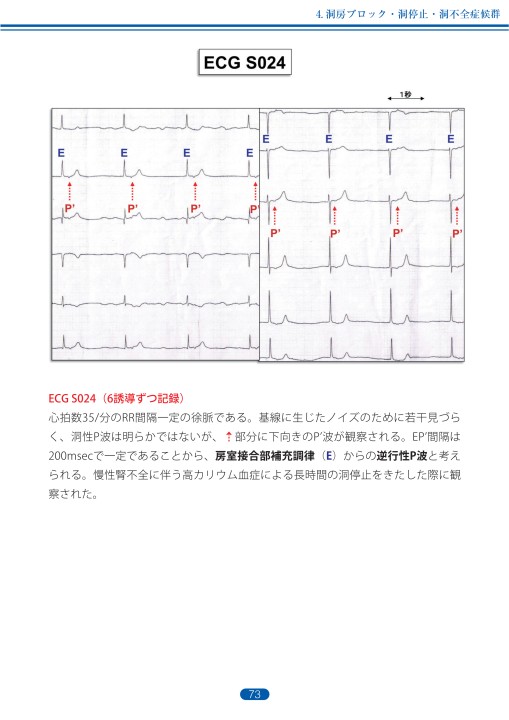 臨床心電図解析の実際 - 不整脈編 第1章・第2章