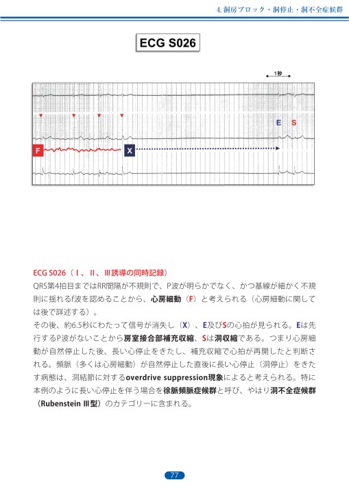 臨床心電図解析の実際 - 不整脈編 第1章・第2章