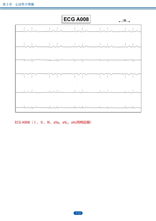 ジョセフソン臨床心臓電気生理学 第2版 41R2xm325fL._AC_SY200_QL15_.jpg