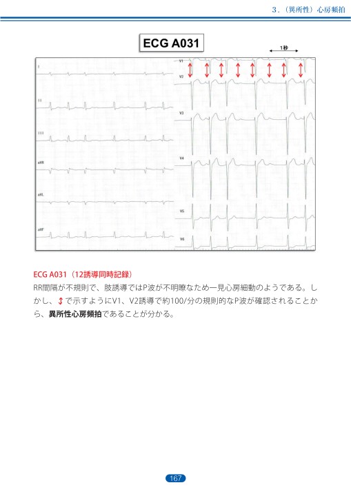 臨床心電図解析の実際 - 不整脈編 第3章