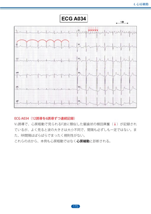 心電図判読集 不整脈編（大型本） 71HMolJFkuL._UF350,350_QL50_.jpg