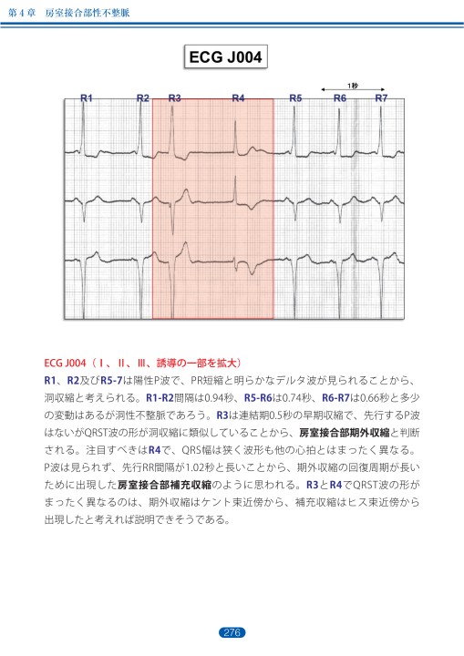 房 室 接合 部 調律 コレクション 反 時計 回転