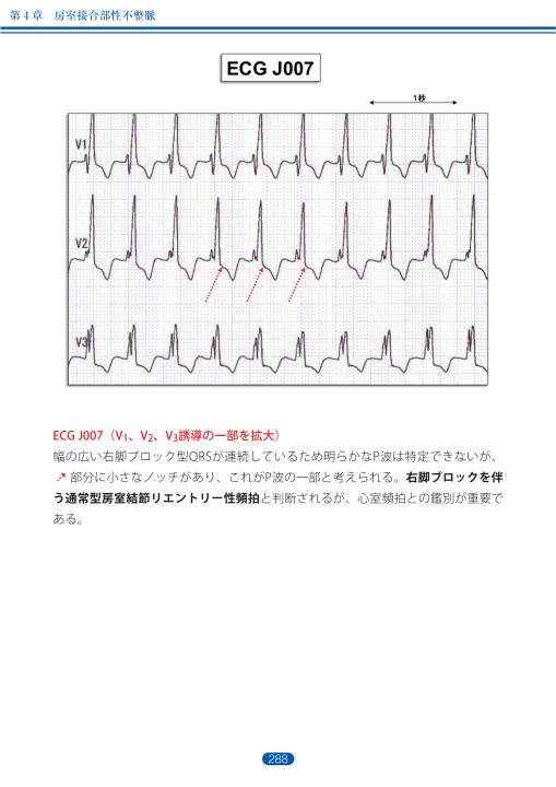 平波図(小)　K-001-2BR2-S 心電図.com on X: 