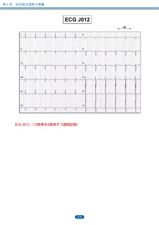 心電図判読集 不整脈編（大型本） 心電図ハンター 心電図×非循環器医 2失神・動悸/不整脈編 | 増井