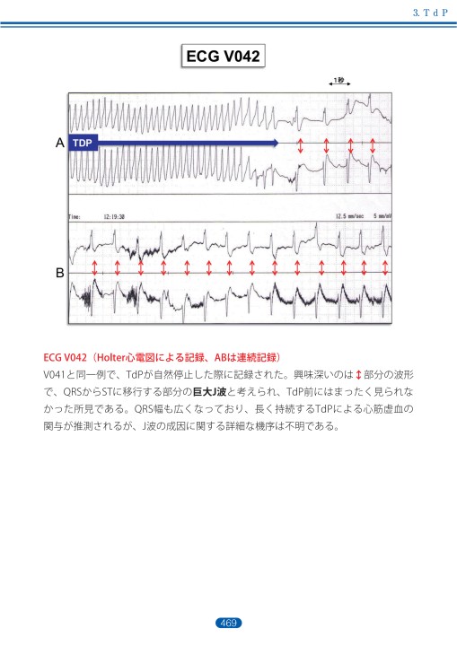 徹底解説!心電図: 基礎から臨床まで | 森博愛 |本 | 通販 | Amazon