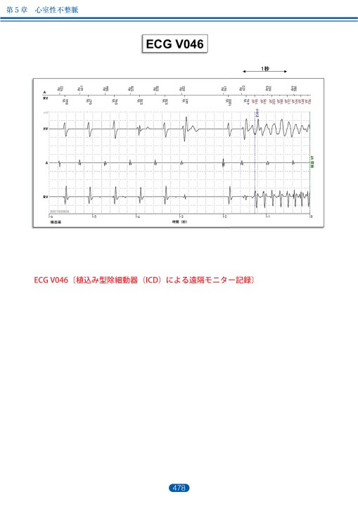 【裁断済み】実力心電図 10.心電図 Q＆A｜学校や職場の検診で心電図の異常といわれたら