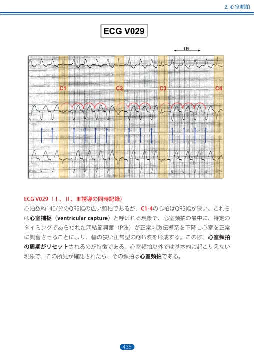 消化器癌治療の広場 臨床試験を斬る！ 第二段階 実際の報告を例