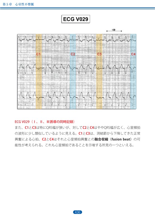 獣医臨床心電図マニュアル 臨床心電図解析の実際 - 不整脈編 第5章